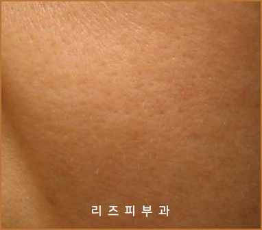 아르네브 이미지