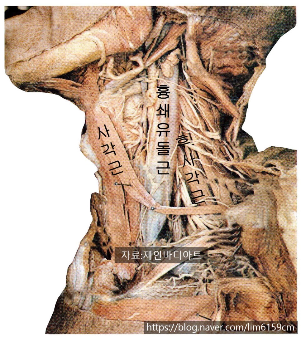 제인바디아트 이미지