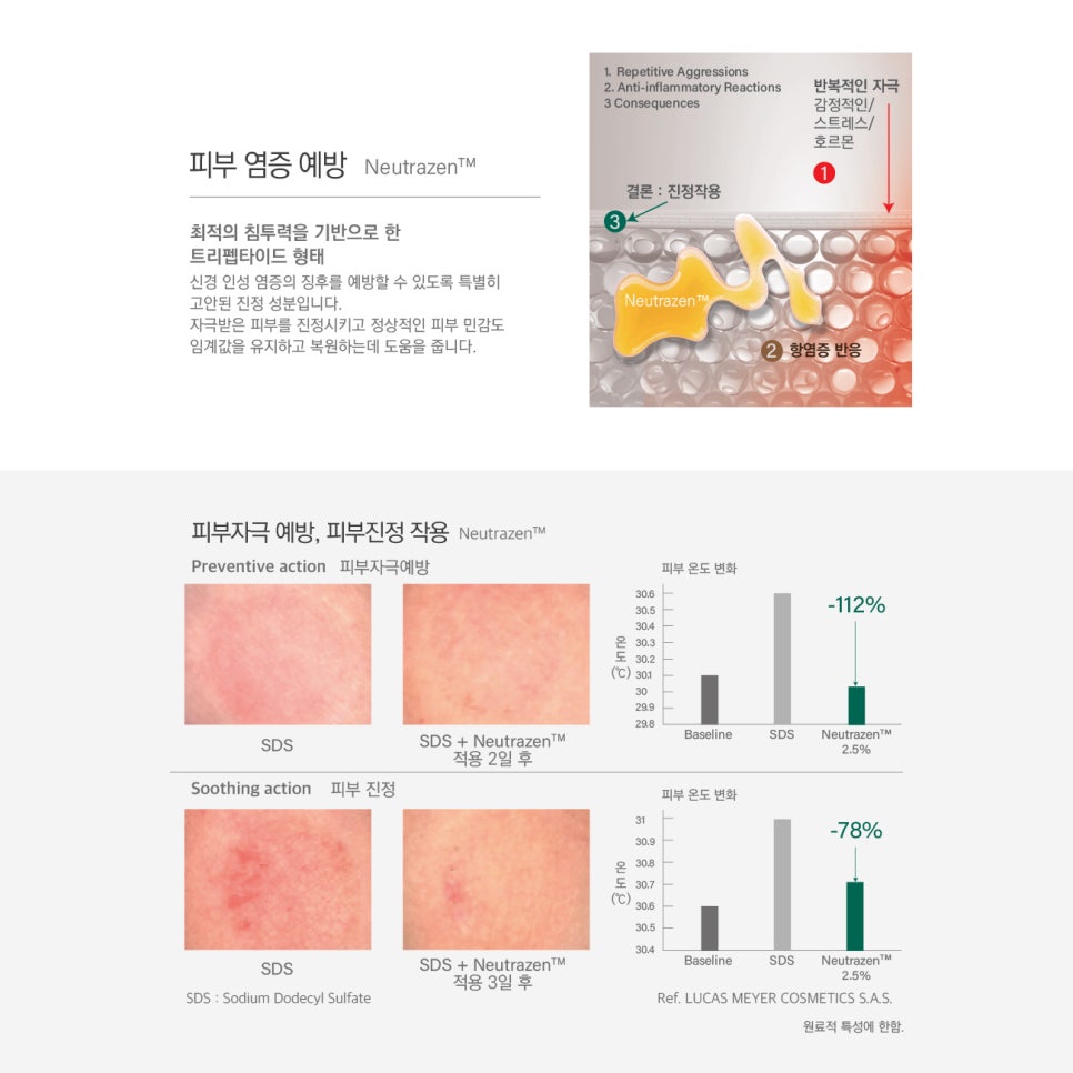 벨르스킨 이미지