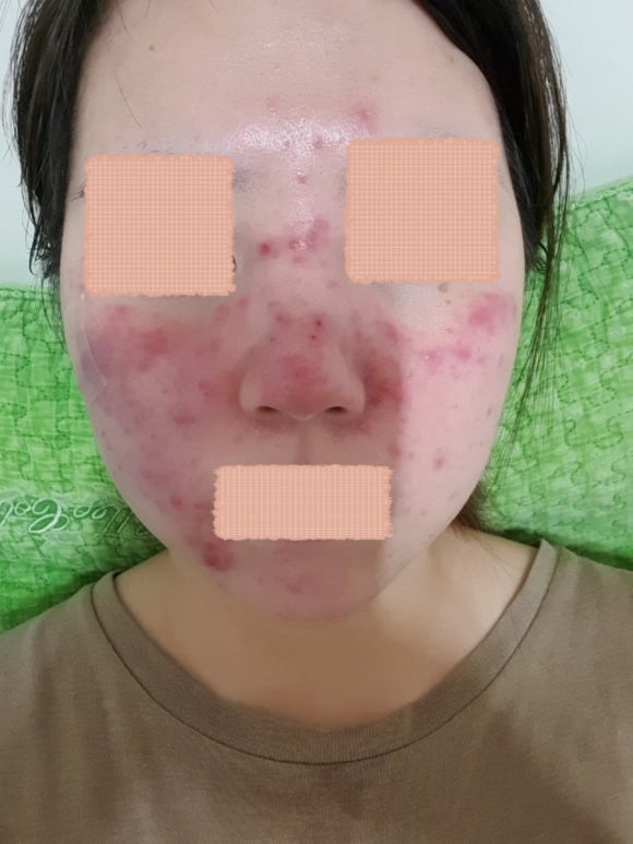 이오스타 이미지