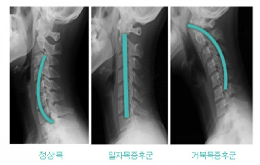 피부야사랑해 이미지