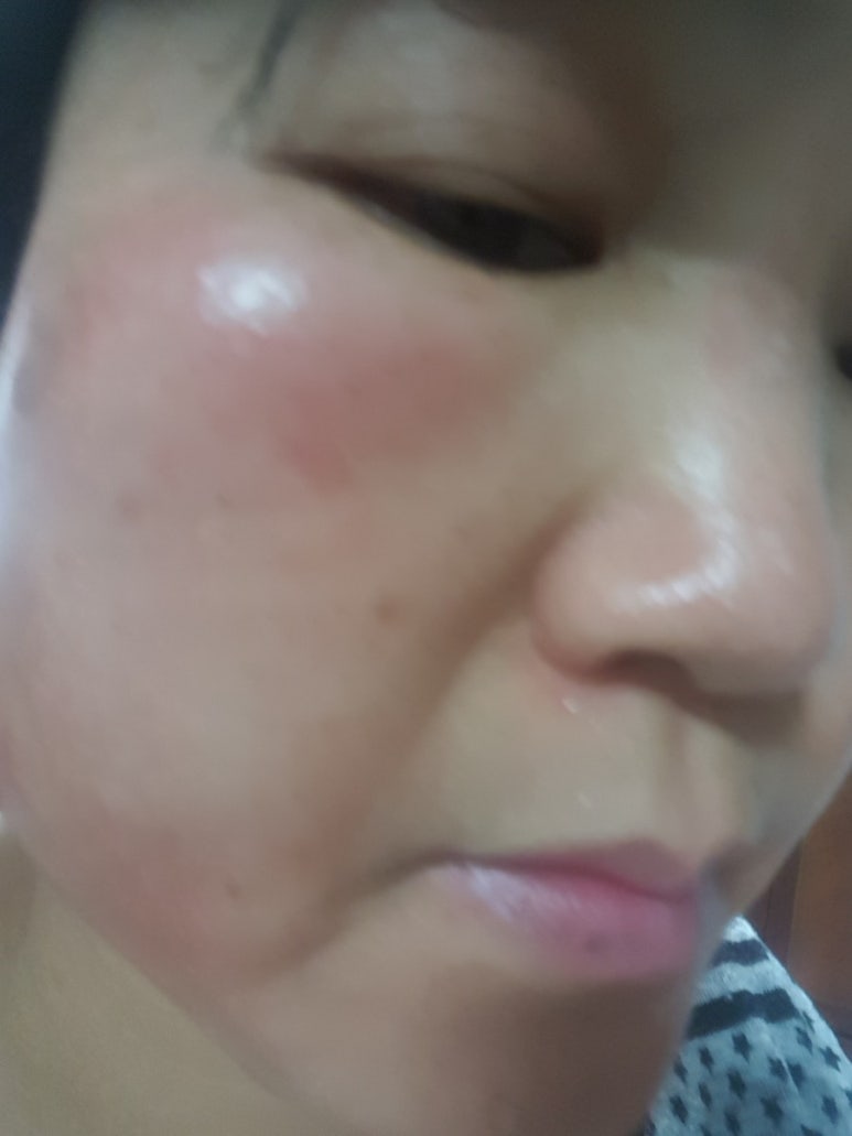 인셀덤 동안 이미지