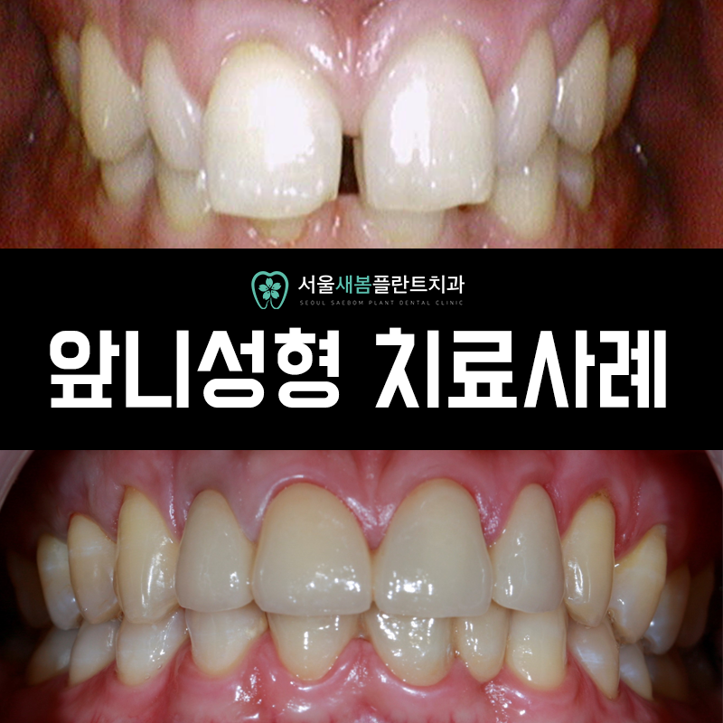 서울새봄플란트치과의원 이미지
