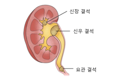 섹칼슘 이미지