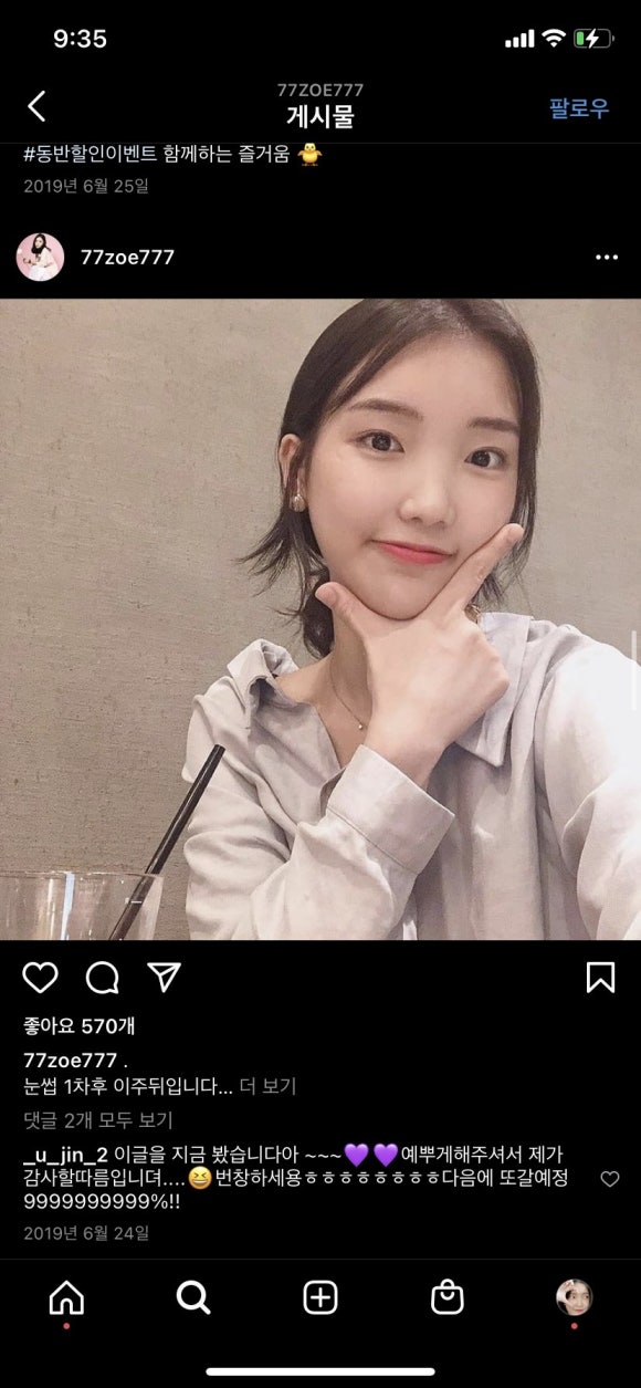 조헤어라인 이미지