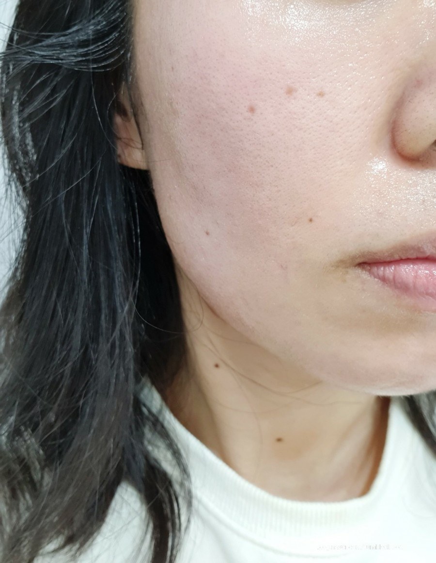 진선미피부 이미지