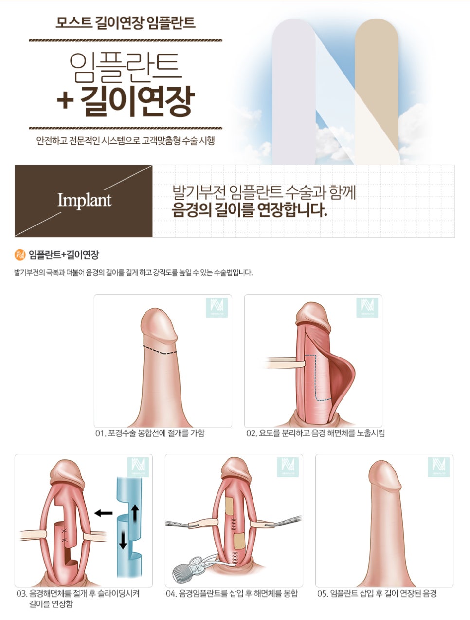 서울엔비뇨기과의원 이미지