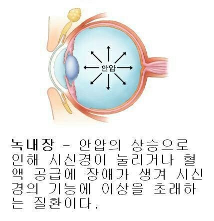 유니플러스비전 이미지