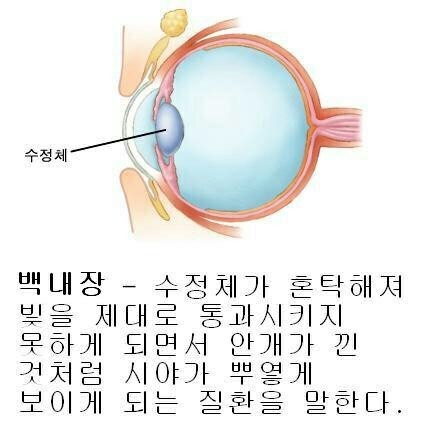유니플러스비전 이미지