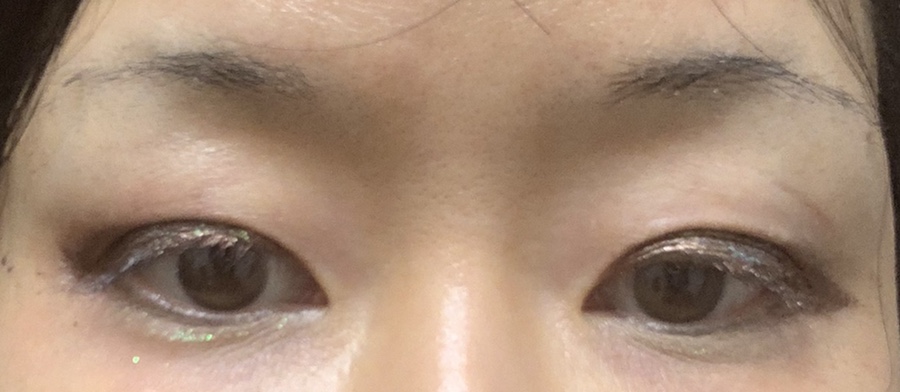 앤트윅 이미지