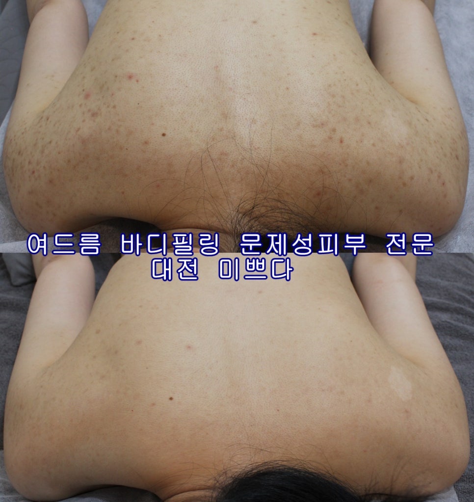 미쁘다피부관리 이미지