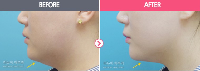 리뉴미피부과 이미지