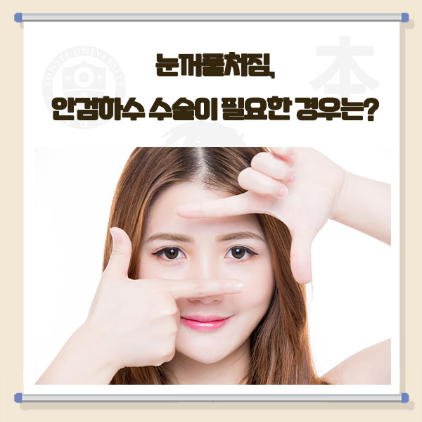 연세본안과의원 이미지