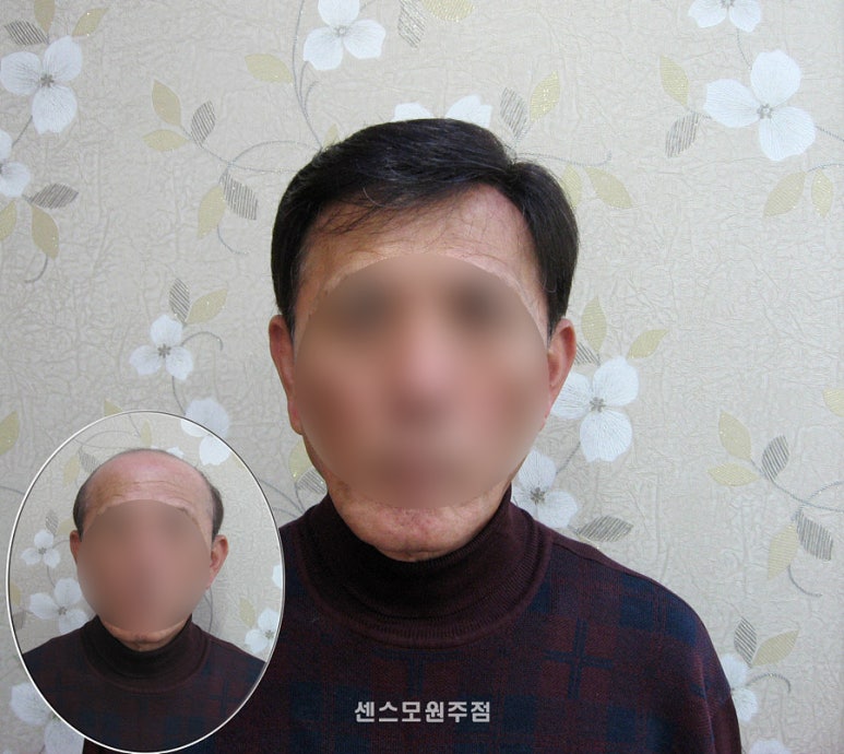 센스모 이미지
