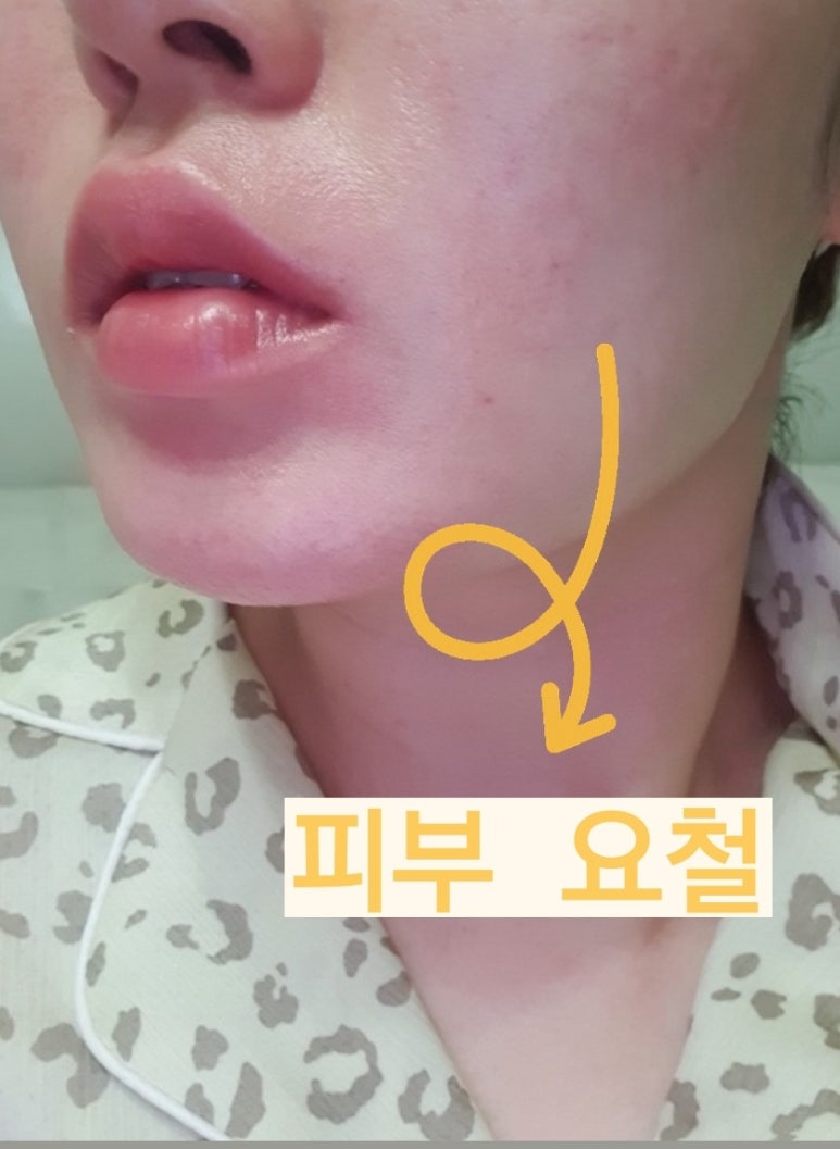 홈케어끝판왕 이미지