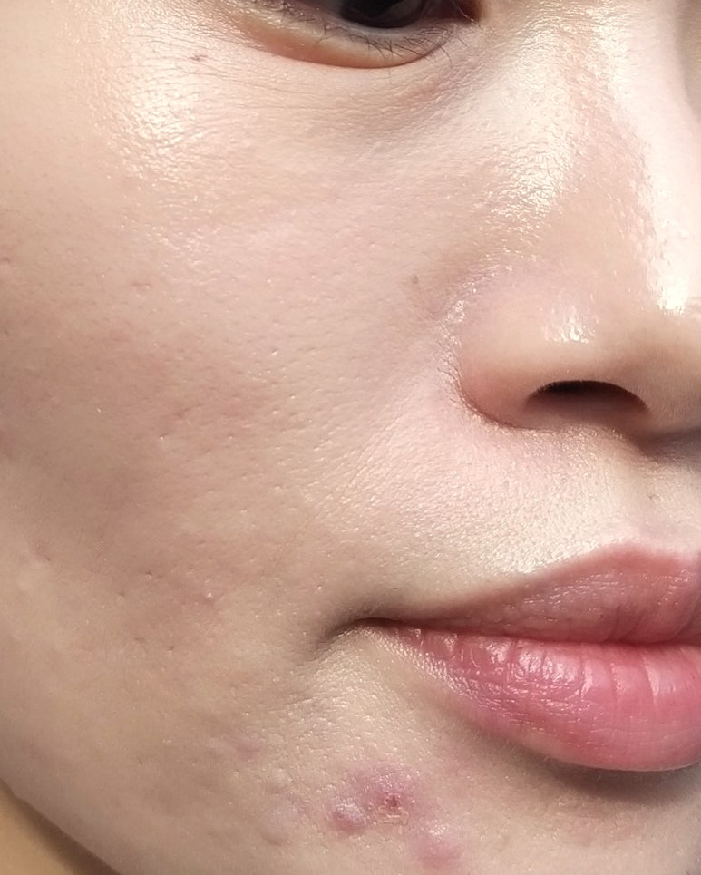 Brown Skin(브라운스킨) 이미지