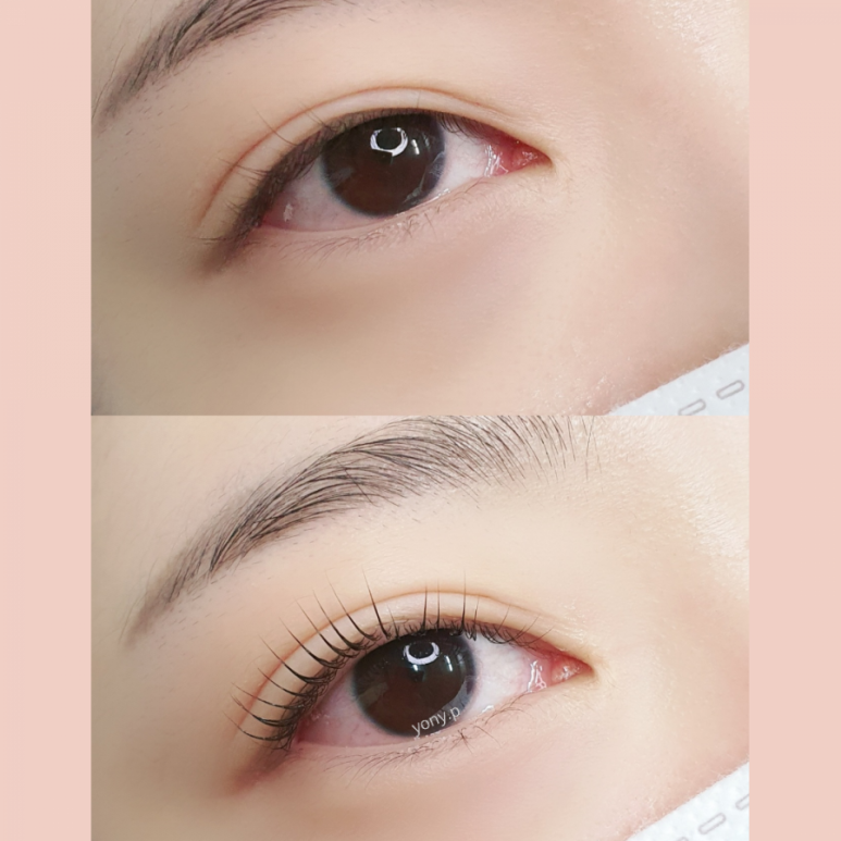 요니뷰티 이미지