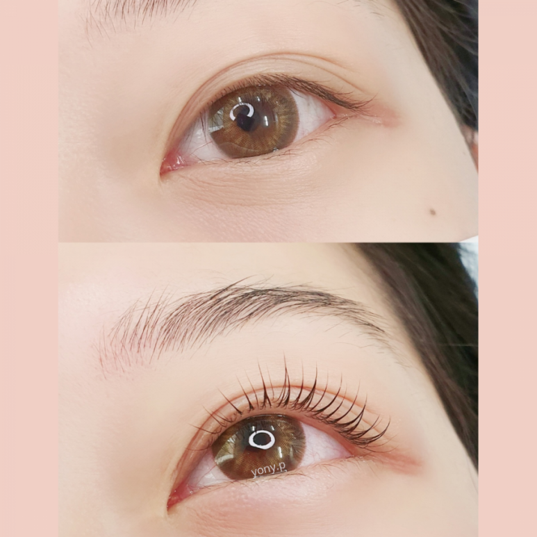요니뷰티 이미지