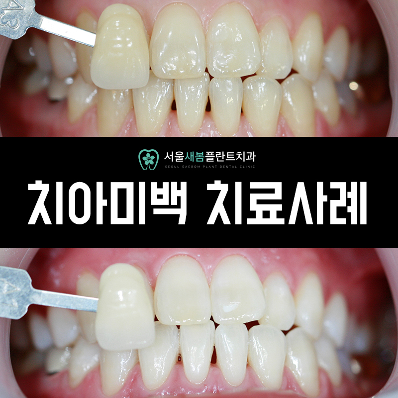 서울새봄플란트치과의원 이미지