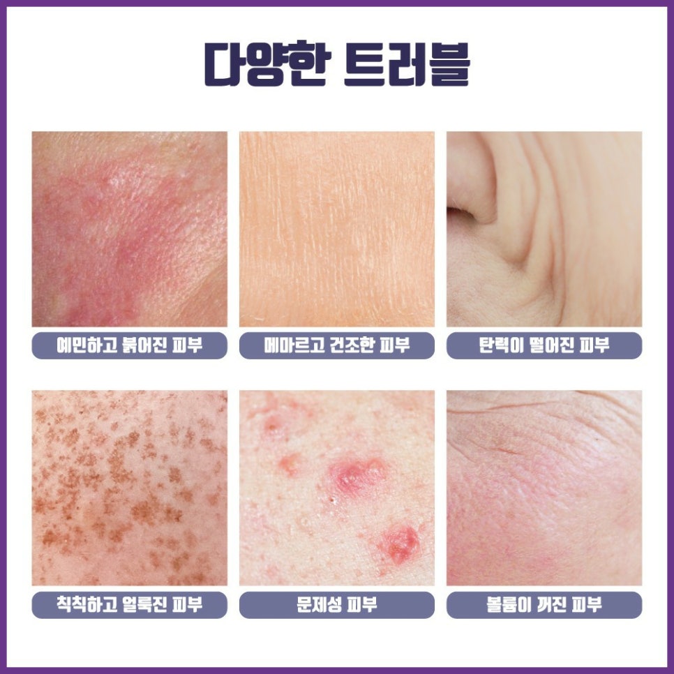 앤네일&피부 이미지