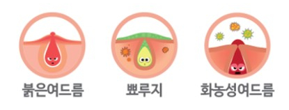 엔젤톡톡 이미지