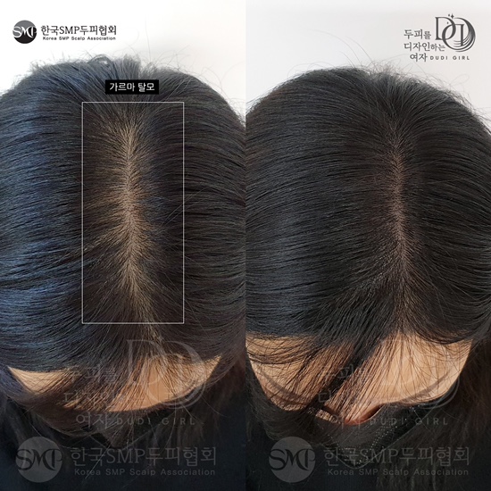 수진뷰티 이미지