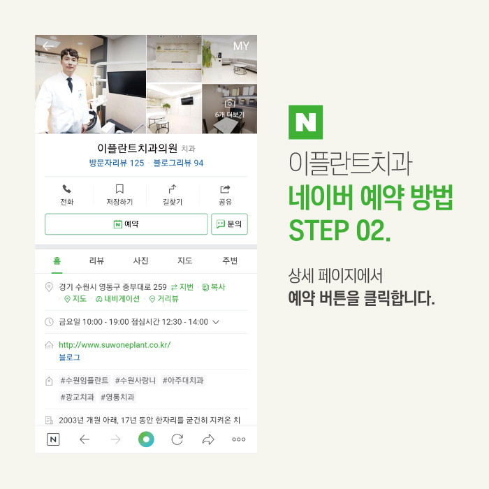 이플란트치과 이미지