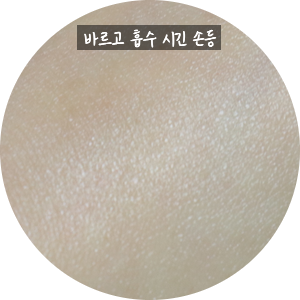 스킨트리 이미지