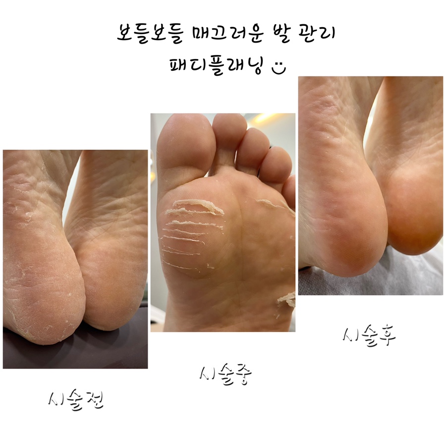봄이네홈케어 이미지