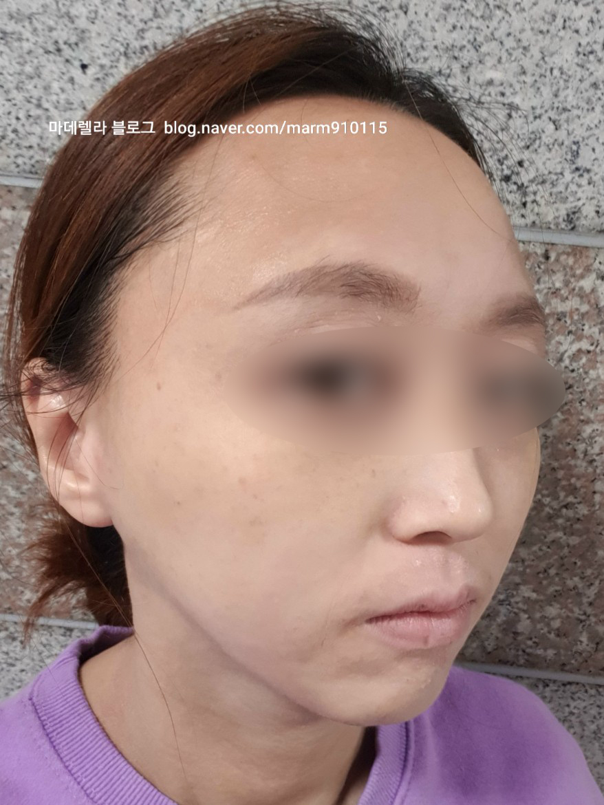 선 피부앤바디 이미지