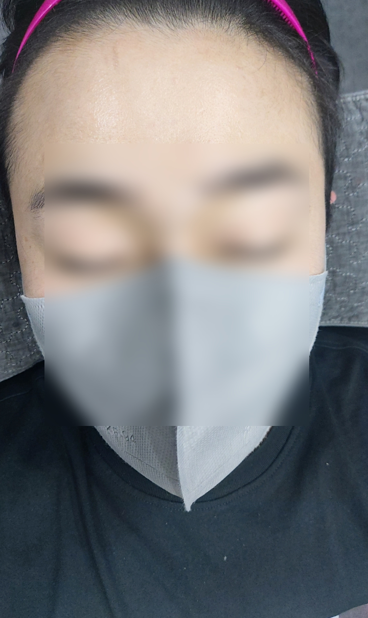 미가헤어라인 이미지