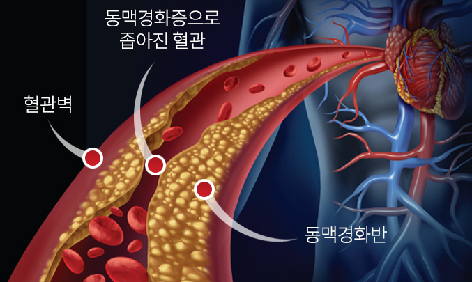 섹칼슘 이미지