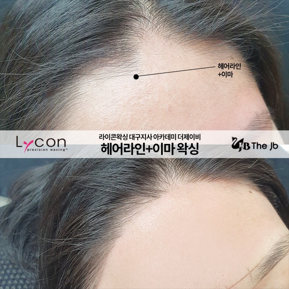 제이비라인 이미지
