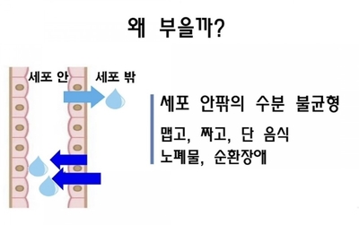 V라인S라인 이미지