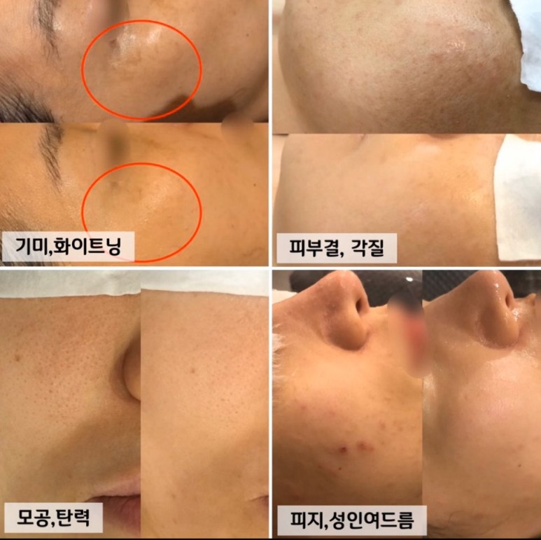피부,맑음 이미지