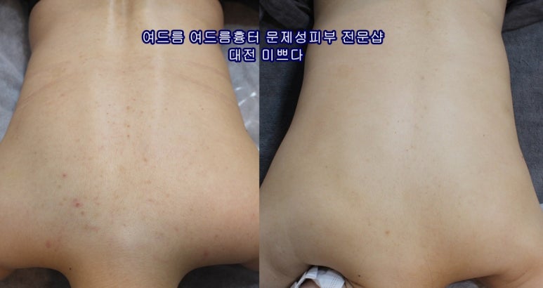 미쁘다피부관리 이미지