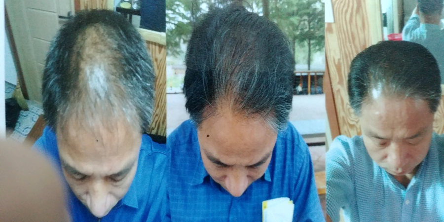 장수 엽록소 이미지