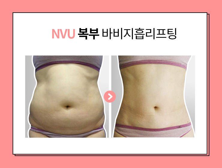 엔비유의원 이미지
