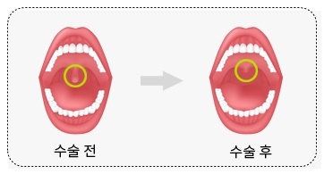 법인두그린 이미지