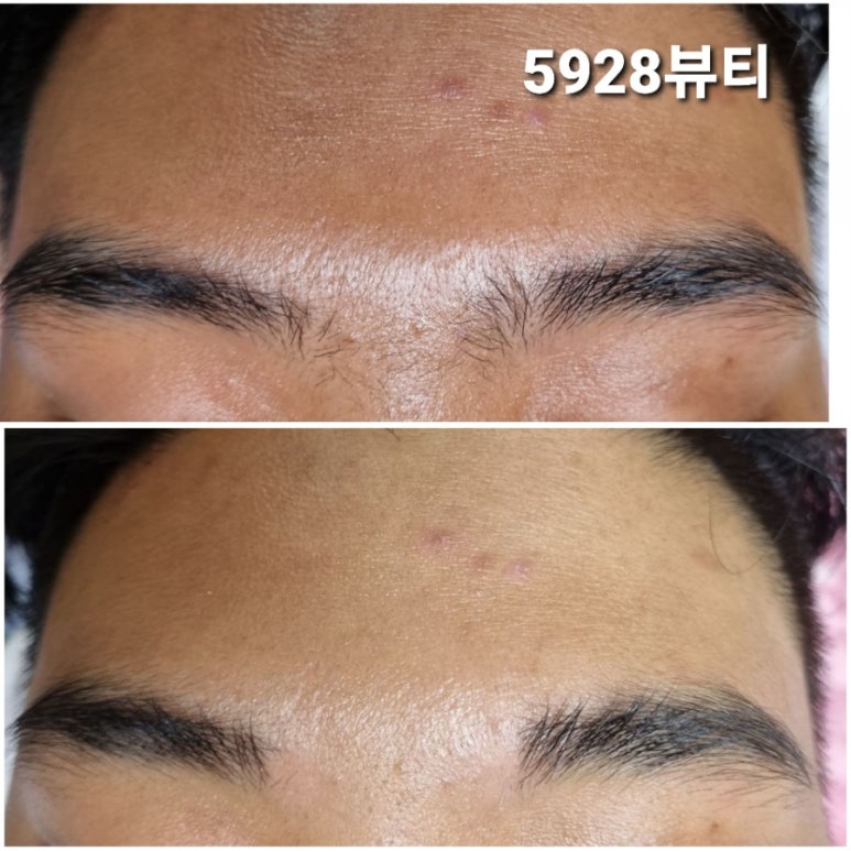 5928뷰티 이미지