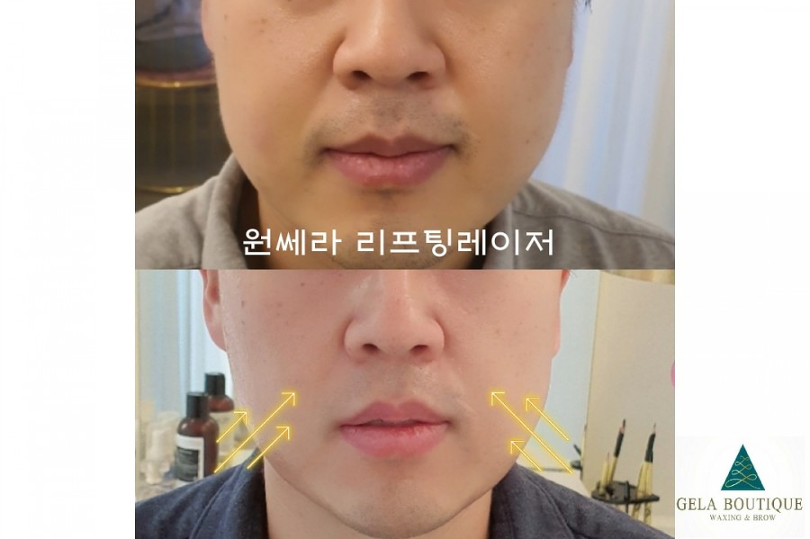 브로우리즈 이미지