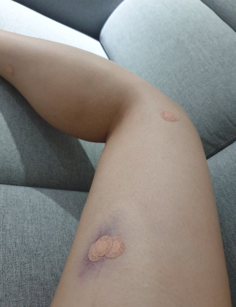 플라덴성형외과 이미지