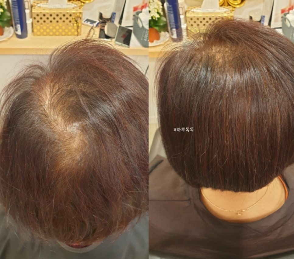 헤어체크 이미지