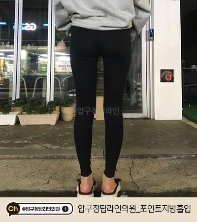 탑라인 이미지