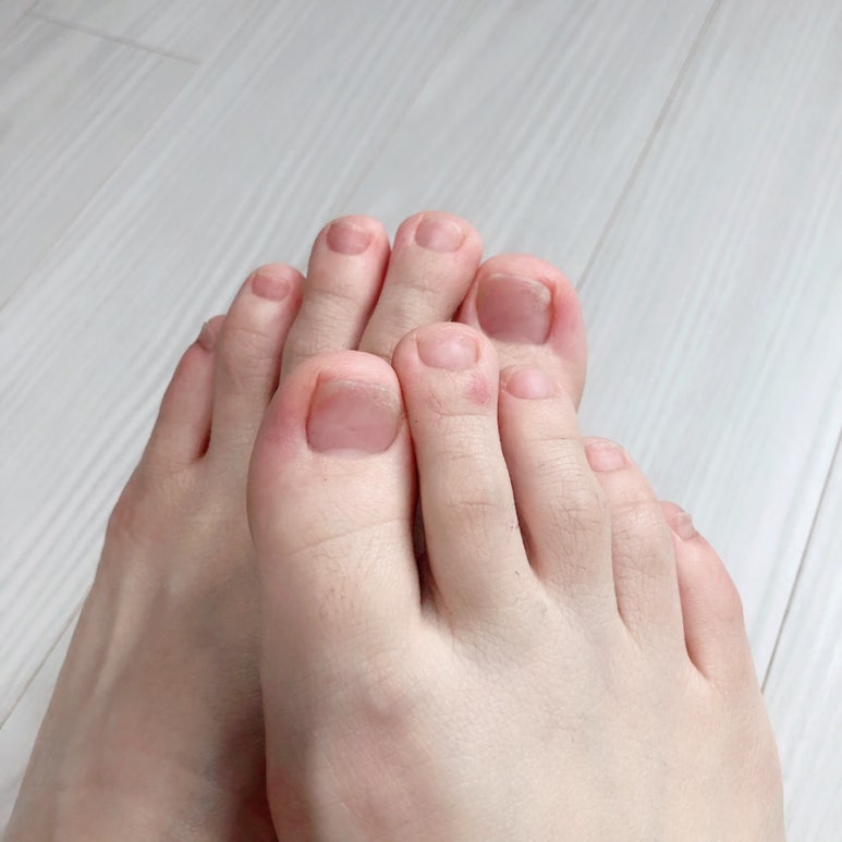 오프오그 이미지
