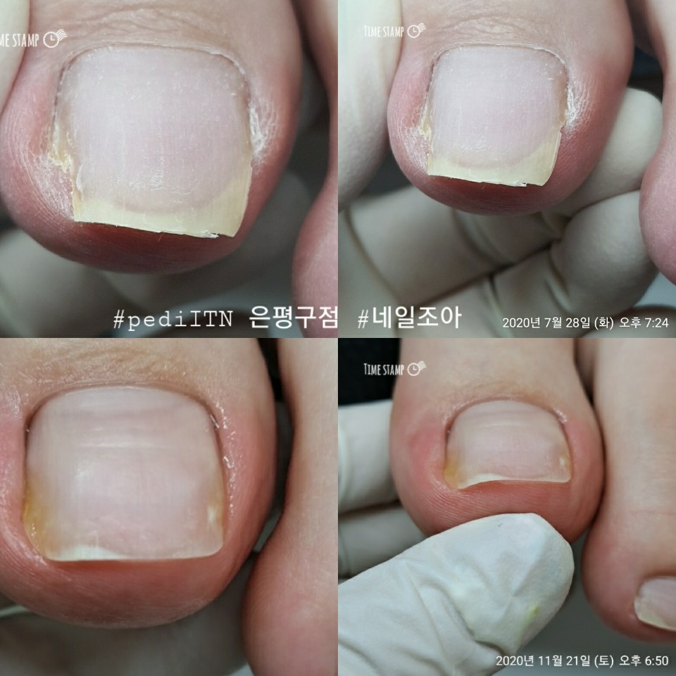 네일조아 이미지