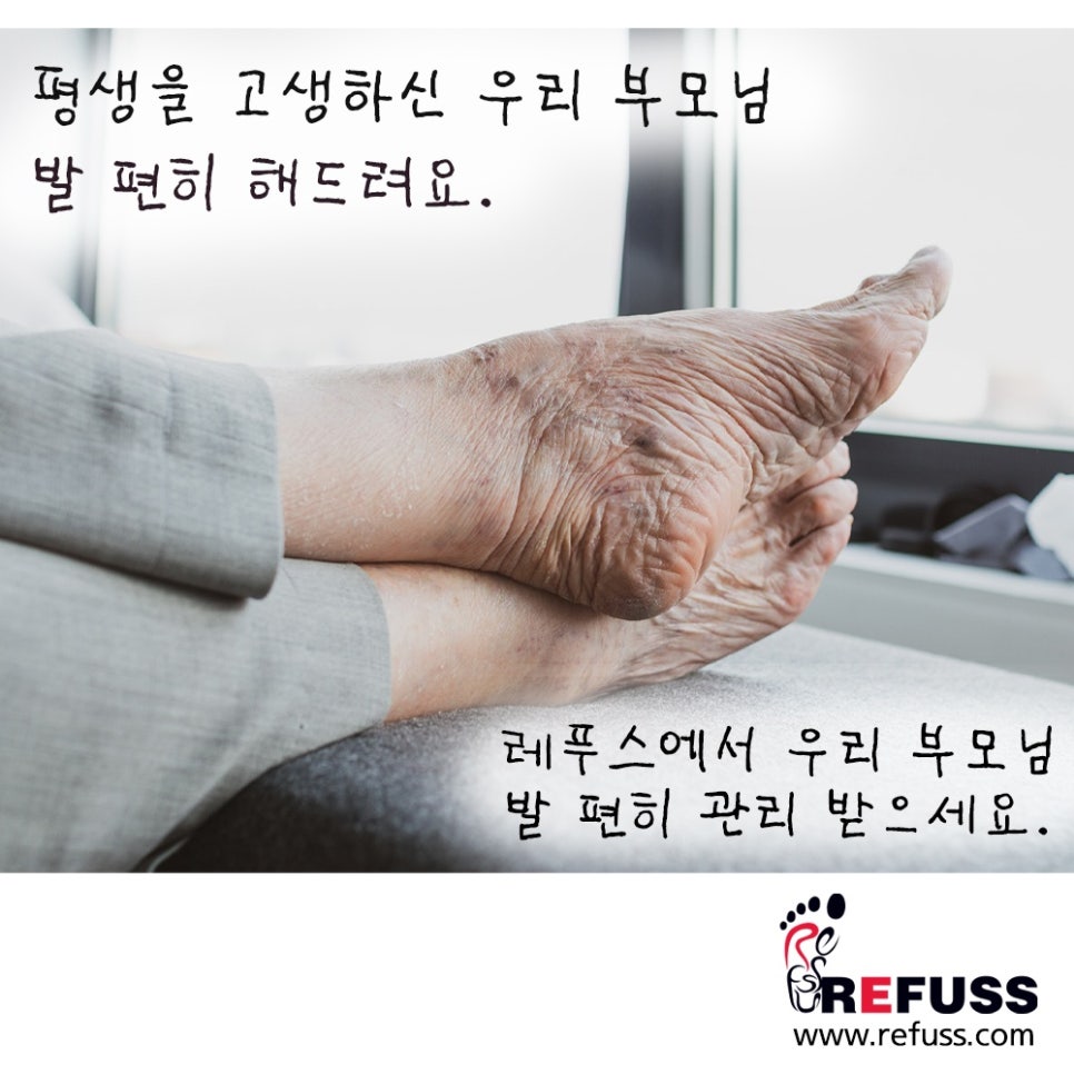 레푸스 이미지