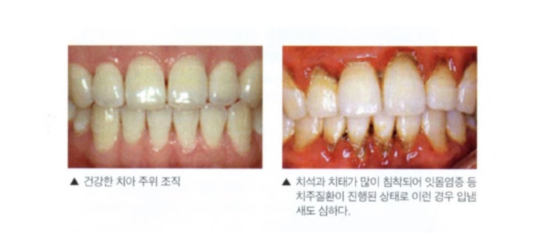 연세탑치과 이미지