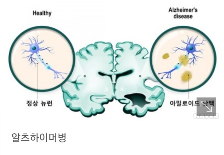 이롬바이오 이미지