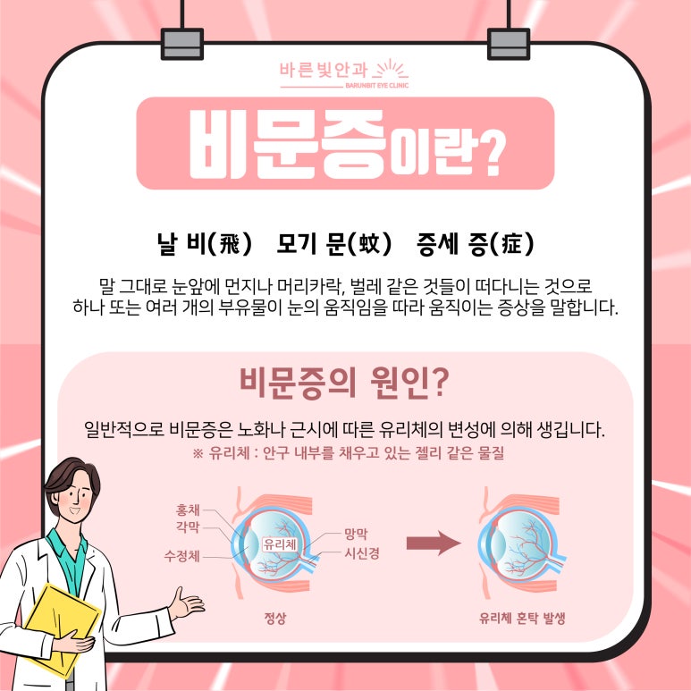 바른안과의원 이미지